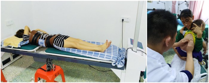 2、那吉镇卫生院开展腰椎牵引治疗(左)和小儿捏脊治疗_副本.jpg
